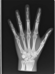 7210xray hand 1.1